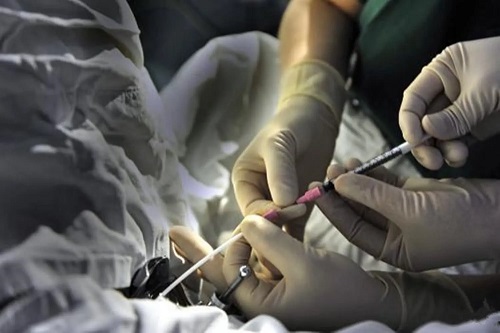 2022三代試管嬰兒技術(shù)適用范圍分別是什么?